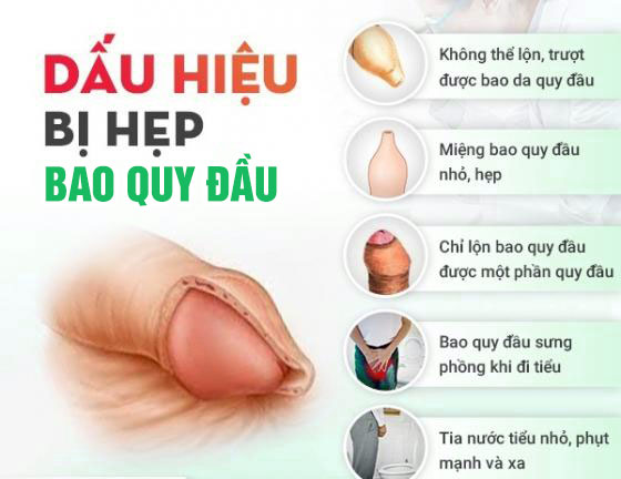 Dấu Hiệu Nhận Biết Hẹp Bao Quy Đầu Ở Nam Giới
