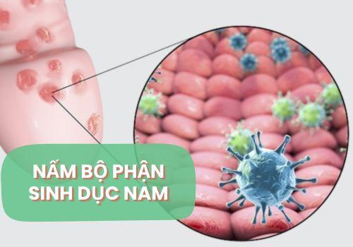 Dấu Hiệu Nấm Sinh Dục Nam
